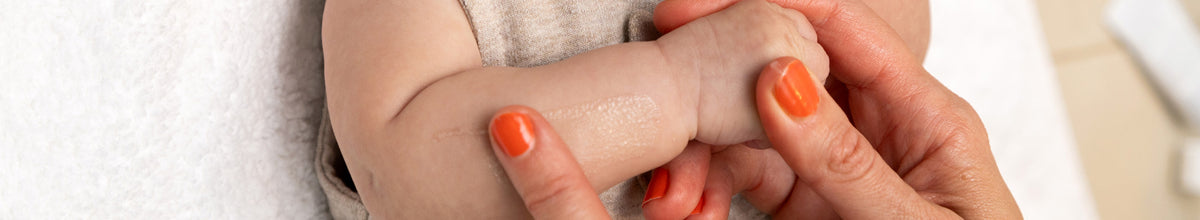 Close-up of a baby's arm held by an mother's hand with orange nail polish on a white background applying BioGaia Skincare Aldermis Probiotic Ointment.